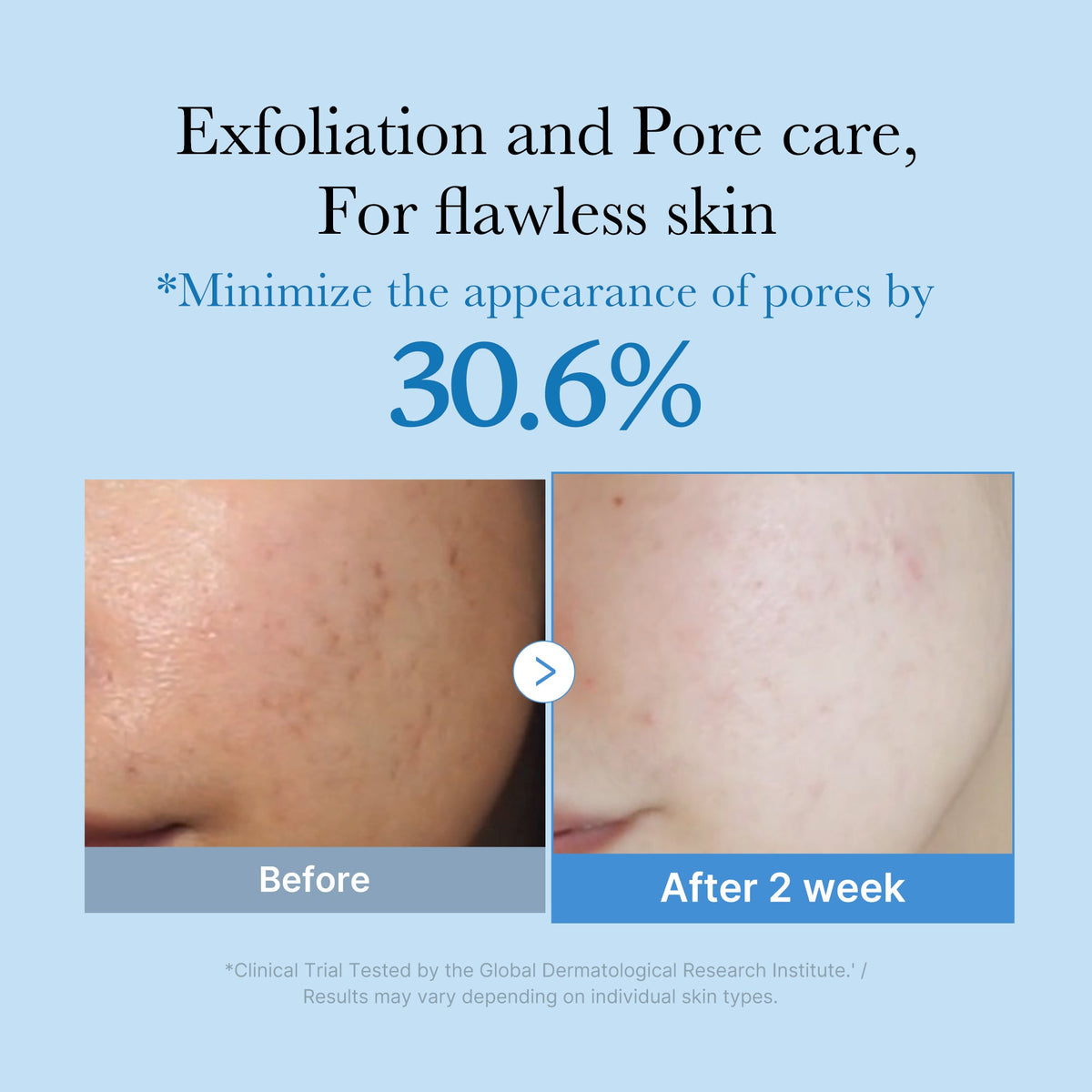 zero-pore-toner-m3 01_d6480b4e-3c08-4954-994a-ed5212c1839c.jpg