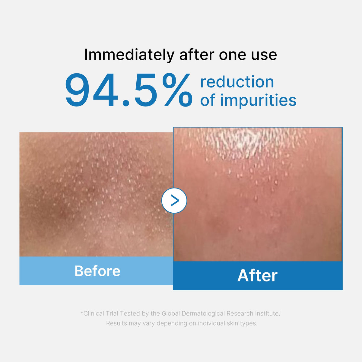 zero-pore-blackhead-deep-cleansing-oil-p5 01_eed557ec-5857-46a2-8b17-dbd67c692dcb.jpg