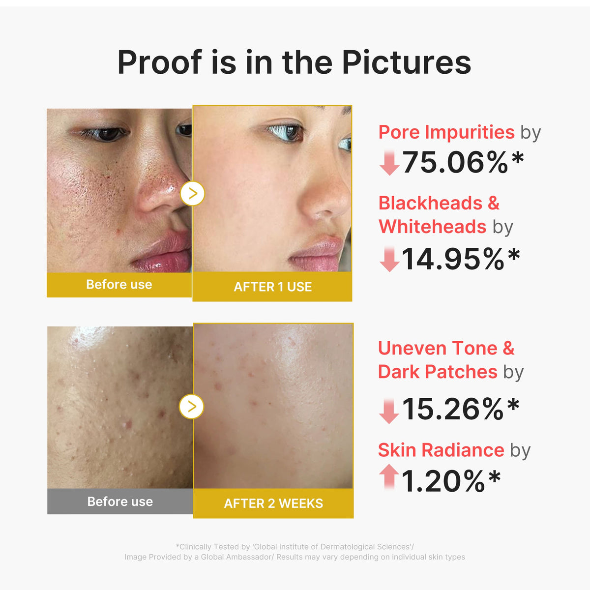 kojic-acid-turmeric-peel-shot-f2 02_45fe66d3-b3f6-4100-aa52-2afd7eded417.jpg