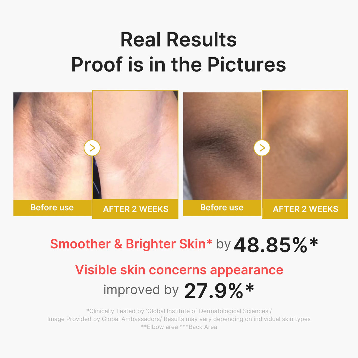 kojic-acid-turmeric-body-peel-shot-j7 02_72880cfc-382b-440b-8152-7e3dce87da2a.jpg