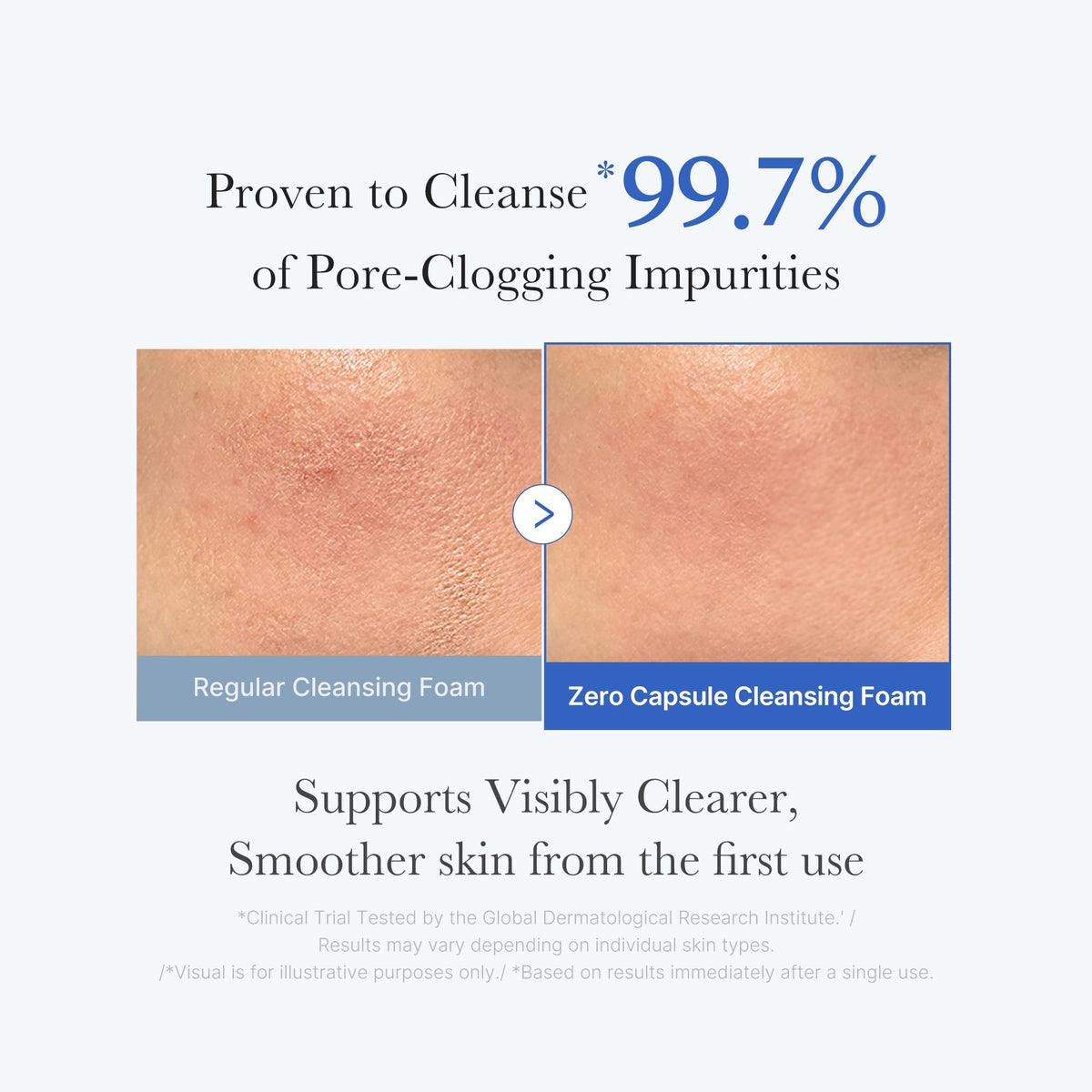 zero-pore-capsule-cleansing-foam-q5 02_c1fb9dfb-86c5-4038-8ff8-490d1006276c.jpg