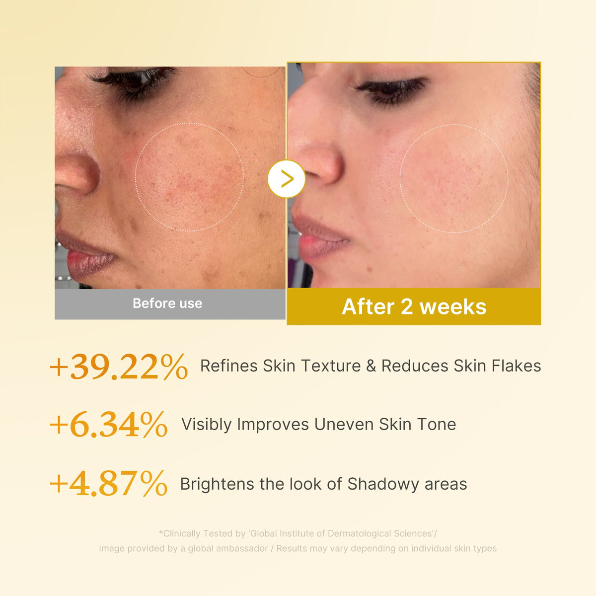kojic-acid-turmeric-toner-z3 03_b7578d52-4c93-4407-9c6c-7cb230c85b06.jpg
