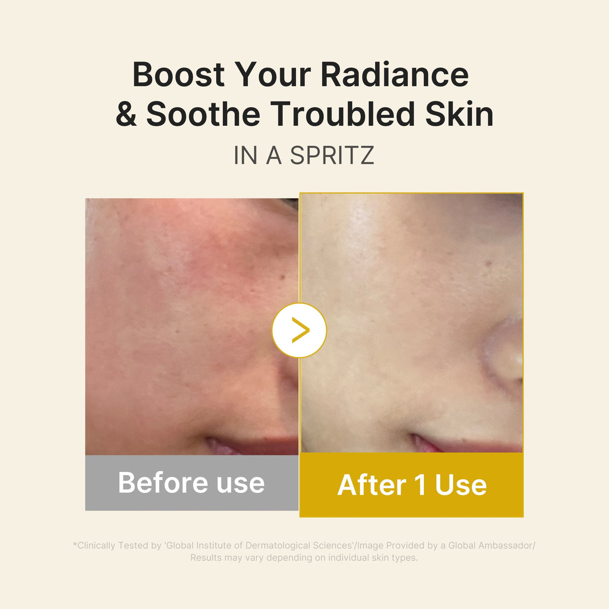 kojic-acid-turmeric-vitamin-gold-jelly-mist-serum-n6 03_dc9cd19e-4e57-49d3-9b66-c7762e8a63f1.jpg