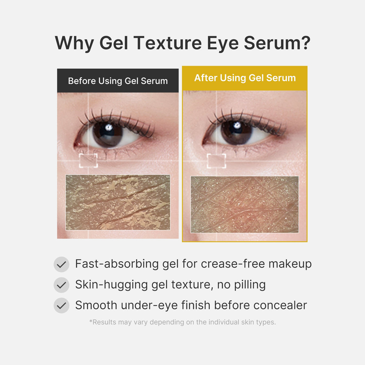 kojic-acid-tumeric-eye-gel-serum-i3 04_0487ef36-49f4-4294-8049-bb55118b05fe.jpg