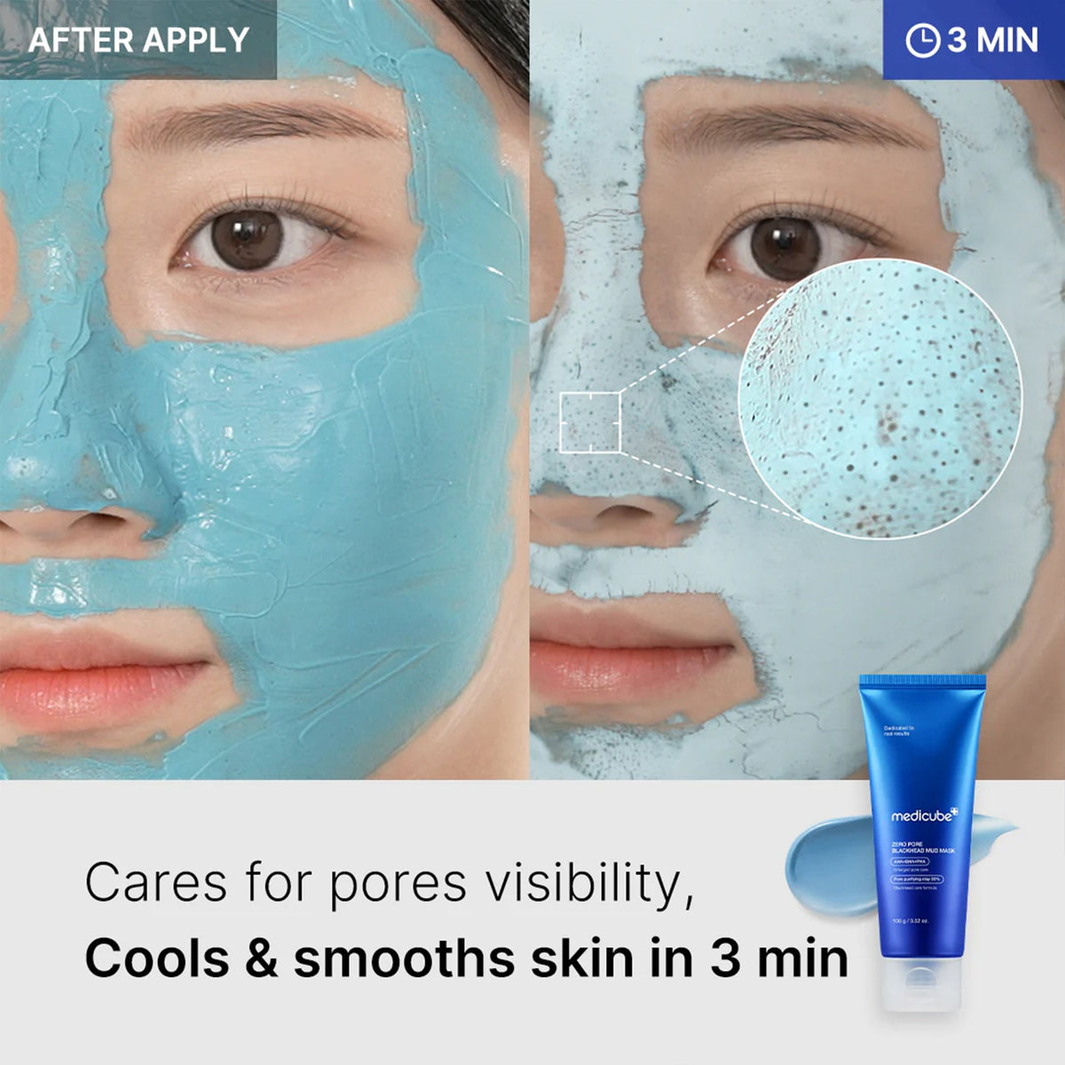 zero-pore-blackhead-mud-mask-z7 04_867c0459-a94e-40d3-bd9a-70400edabe8d.jpg