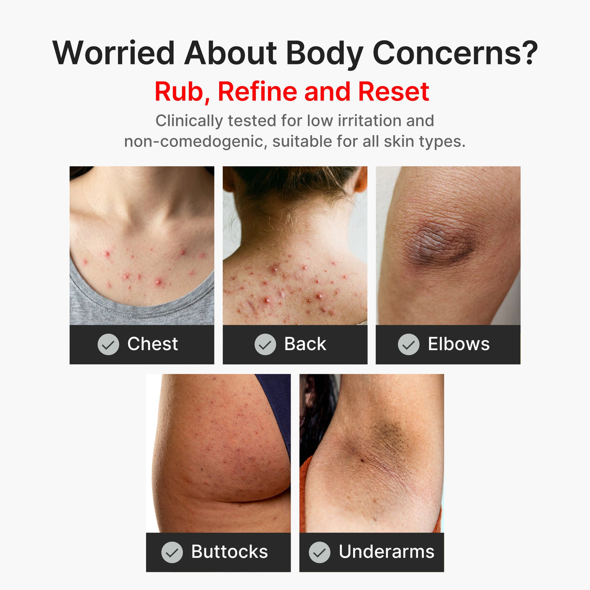 kojic-acid-turmeric-body-peel-shot-j7 04_8a7237f2-3ebf-401e-bd85-54841aeb3efc.jpg