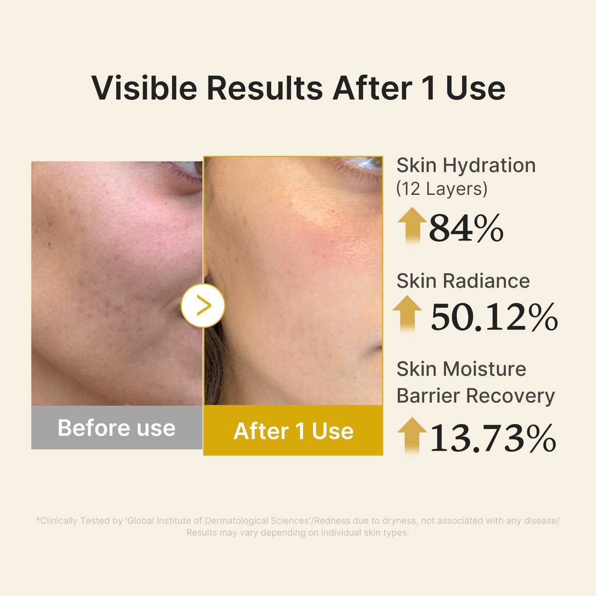 kojic-acid-turmeric-vitamin-gold-jelly-mist-serum-n6 04_d5c55ef1-e03b-494d-bc0d-a1ecc7fc2abf.jpg