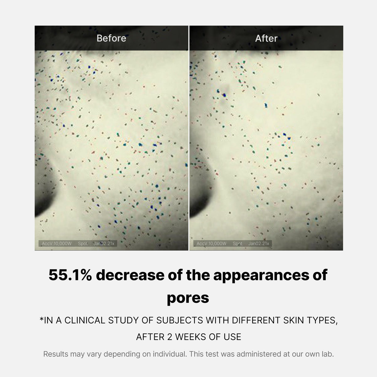 pore-care-duo-g4 05_12ddab8a-64be-4612-8ee1-27e5ec701921.jpg