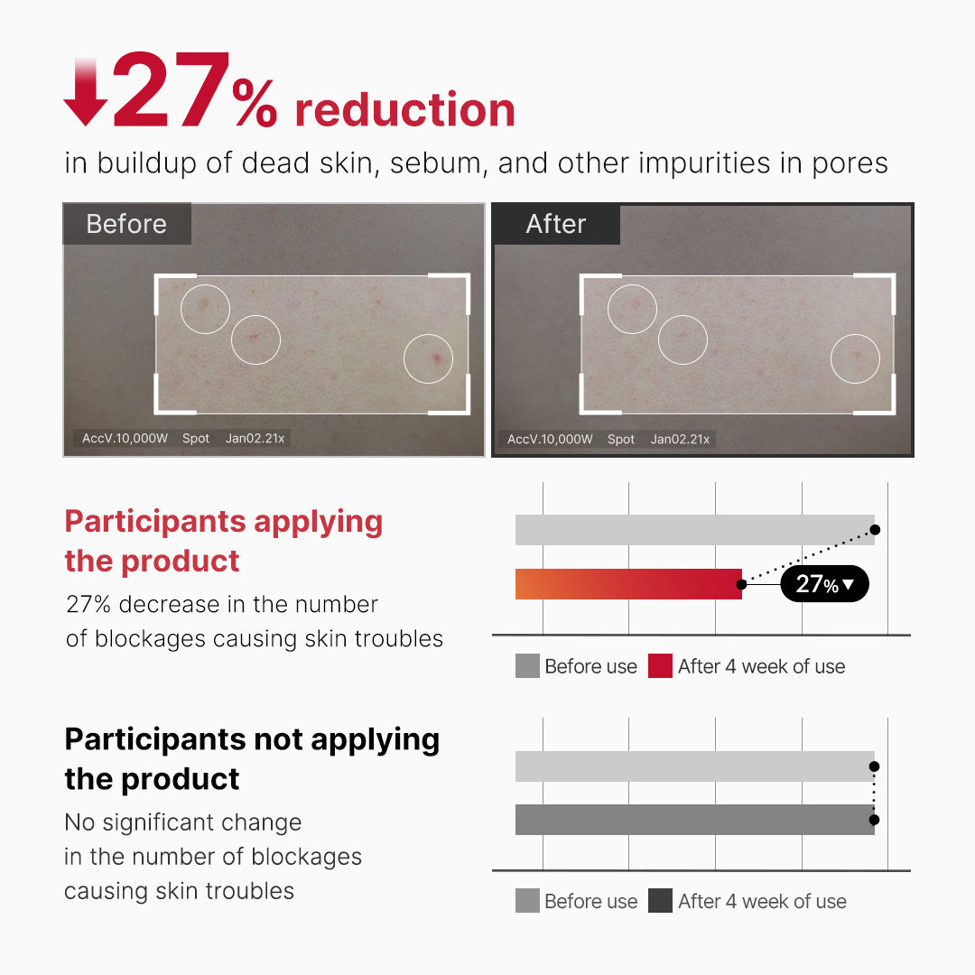red-body-peeling-shot-cleanser-y7 07_60b5b2fd-b0f0-4cae-b358-5c38181e8dd8.jpg