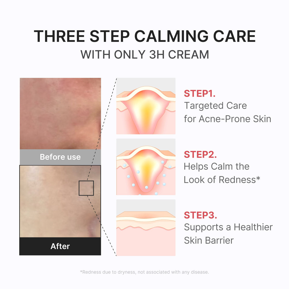 3h-daily-relief-cream-p0 3H_04.jpg