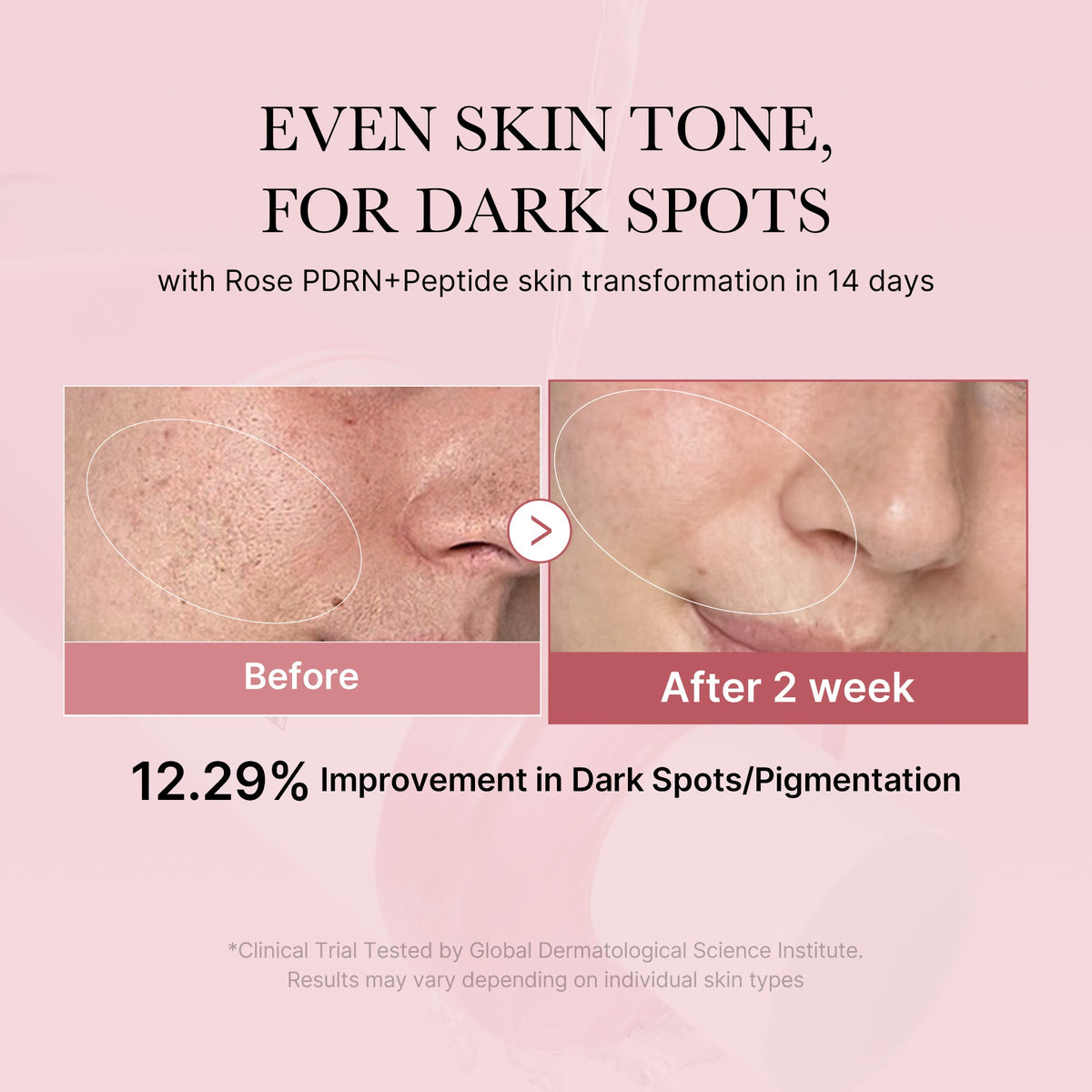 pdrn-pink-peptide-toner-h0 PDRN_01_308c518e-5ac6-4e54-99bd-eabc8796739b.jpg