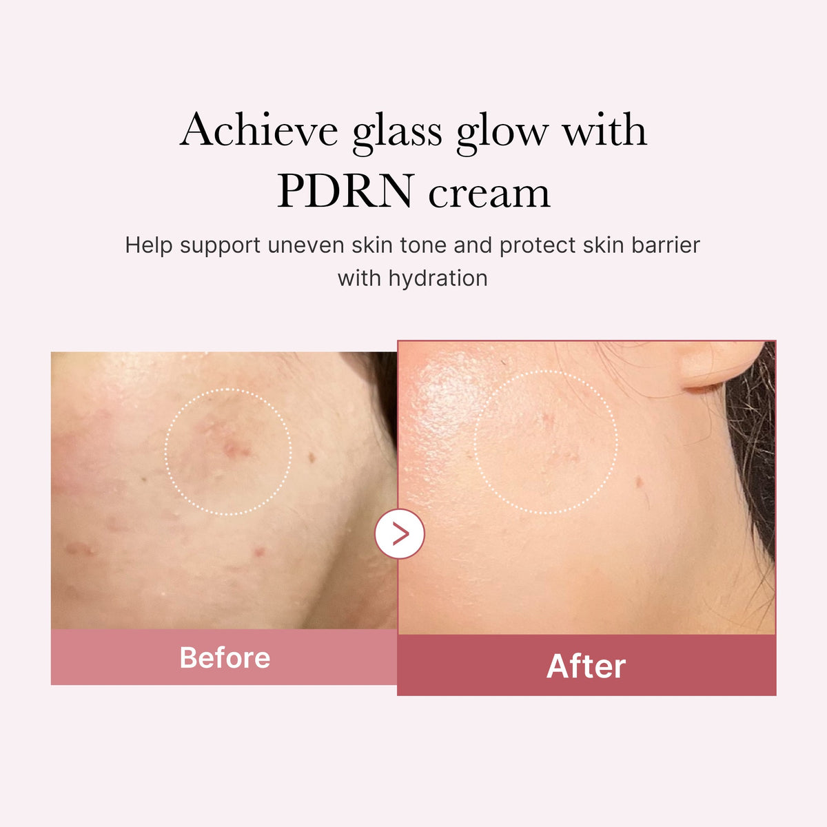 pdrn-pink-peptide-cream-c9 PDRN_02_d7805bfe-cf43-446a-b71b-a276683f136b.jpg