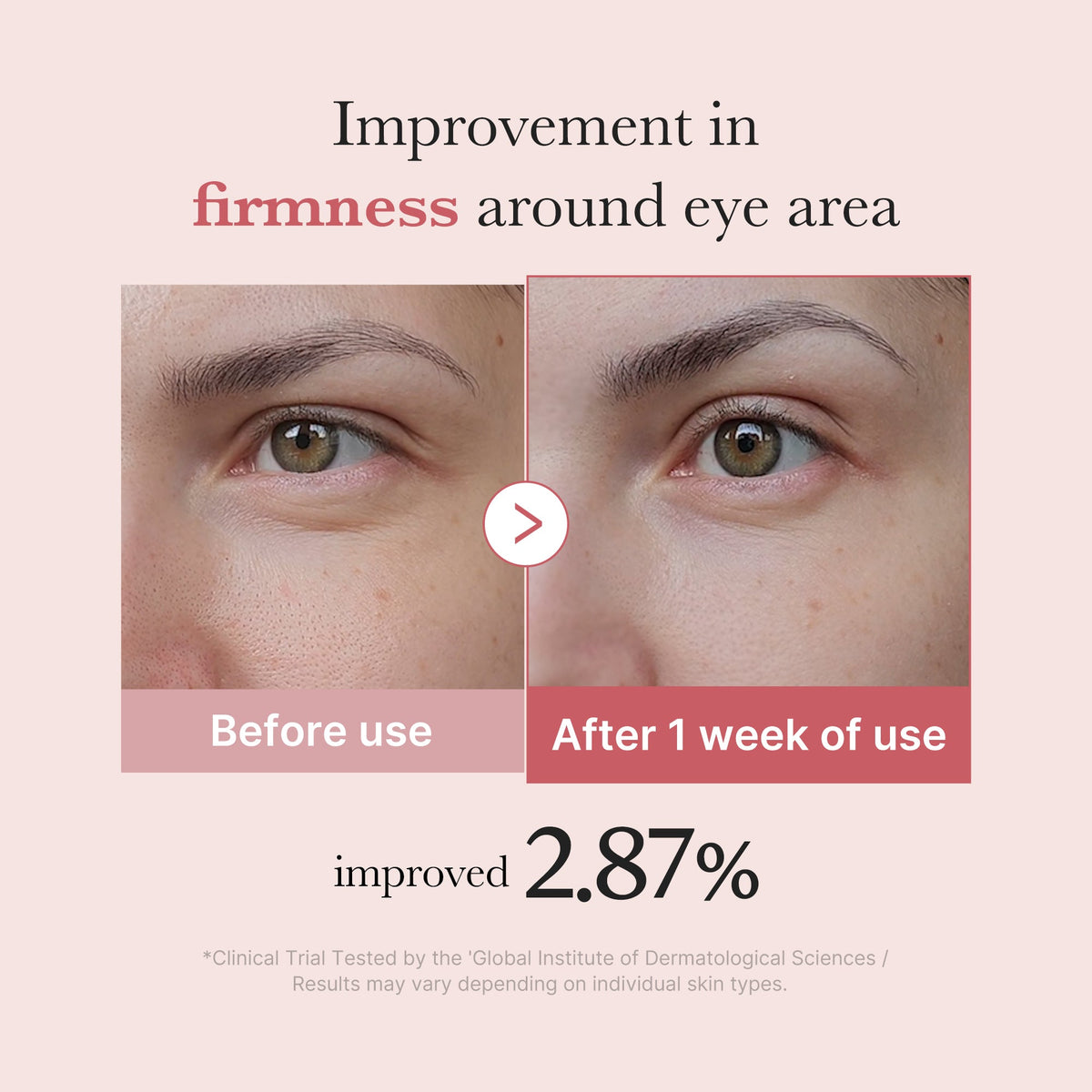 pdrn-pink-peptide-eye-cream-w4 PDRN_03_256dd753-0a2f-41b4-b3cd-bbfd3bc27018.jpg