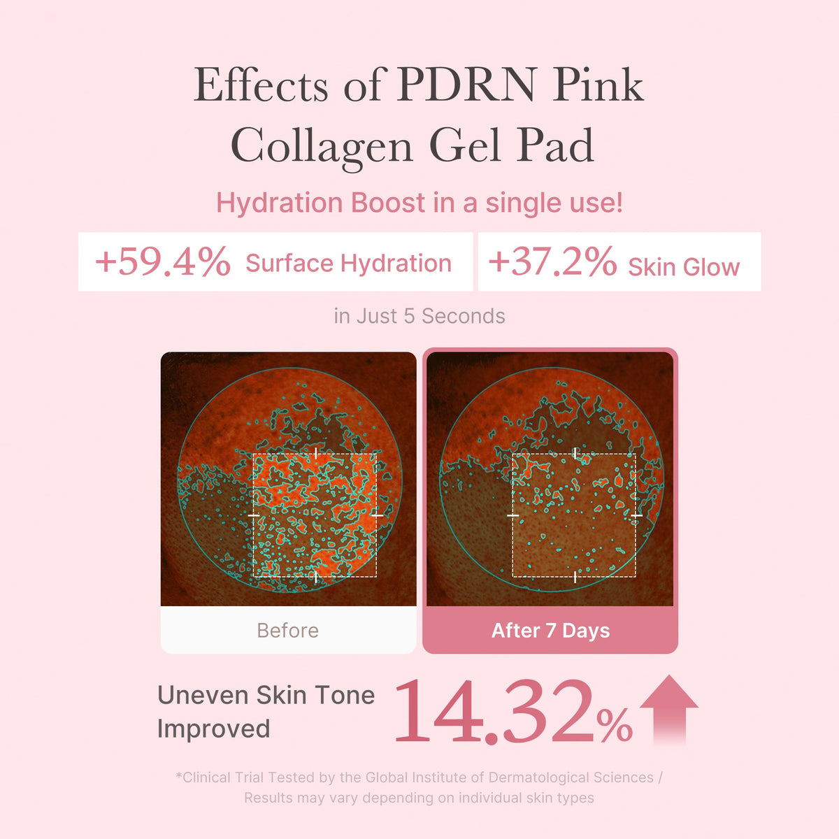 pdrn-pink-collagen-gel-toner-pad-d6 PDRN_04_f9a16a56-8d9e-4c47-a635-ed34ec3ed571.jpg