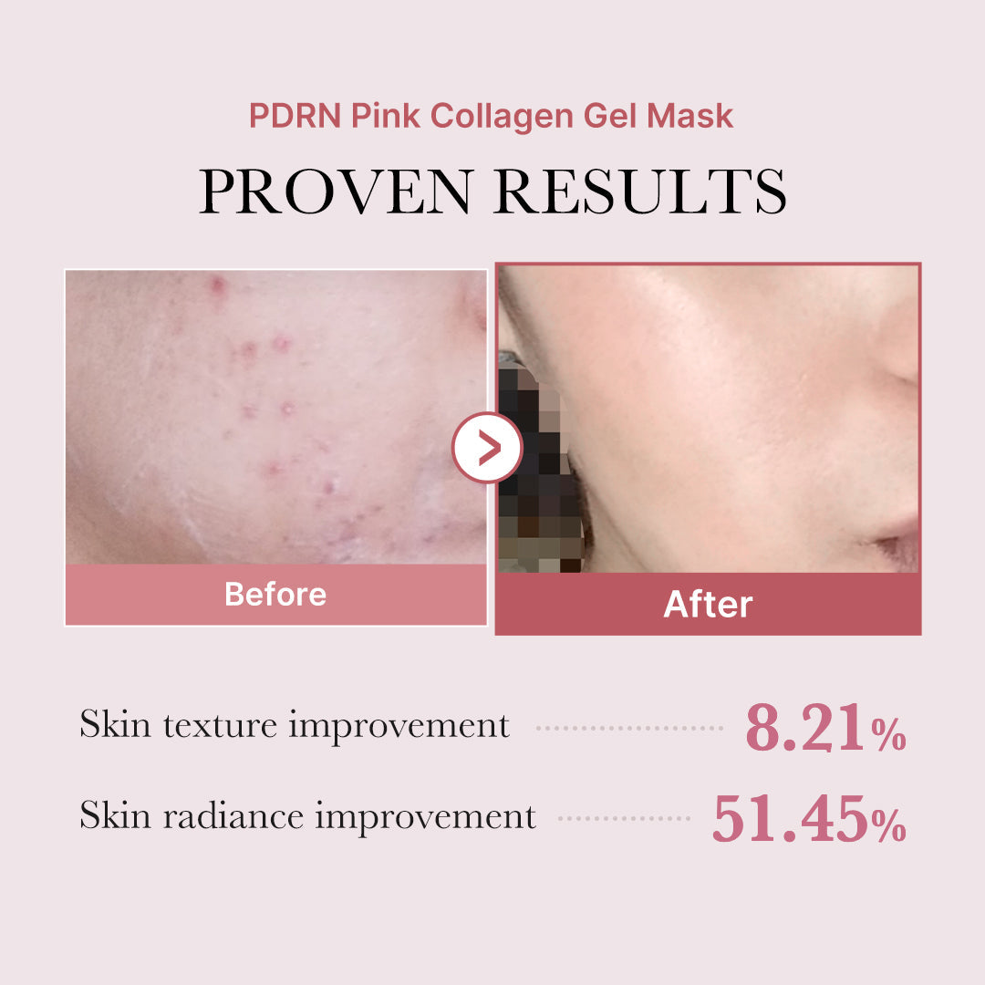 pdrn-pink-glow-full-set-t8 PDRN_12.jpg